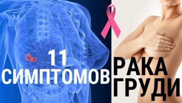11 симптомов рака груди, которые чаще всего не замечают
