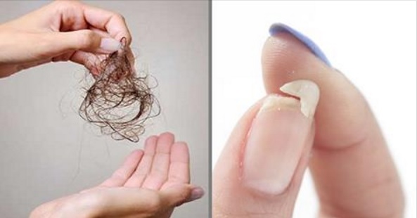 Вам нужно добавить в свой рацион ЭТО, если у вас ломкие ногти, выпадают волосы, или же если вас мучает бессонница!