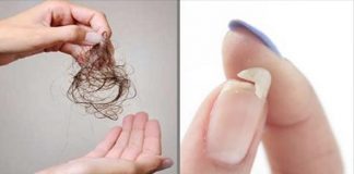 Вам нужно добавить в свой рацион ЭТО, если у вас ломкие ногти, выпадают волосы, или же если вас мучает бессонница!