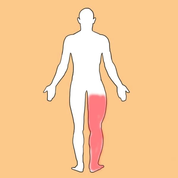 Тромбоз глубоких вен — 8 симптомов, которые нужно выучить наизусть