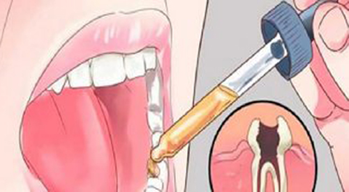 Знаете, как быстро снять зубную боль всего лишь за пару секунд? Даем рецепт!