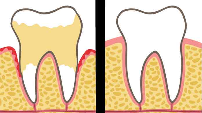 Стоматологи объясняют 7 привычек, которые разрушают ваши зубы и десны (и как их исправить)