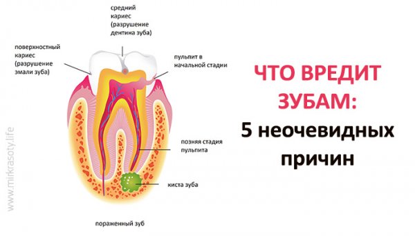Что вредит зубам: 5 неочевидных причин