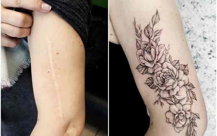 50 человек, которым татуировщики прекрасно покрыли свои шрамы и родимые пятна