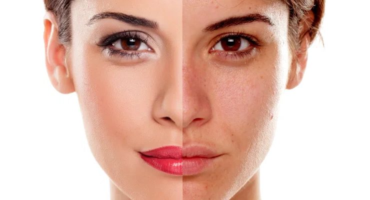 11 причин, по которым женщины выглядят великолепно без макияжа